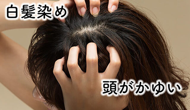 白髪染めによる頭皮のかゆみはアレルギーの危険性！美容師が原因や対策を解説！